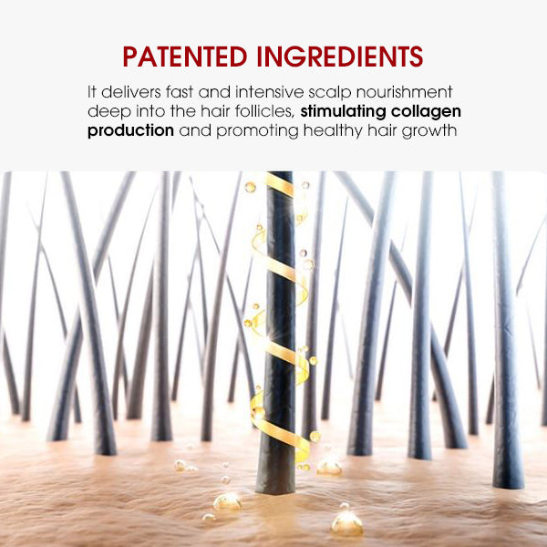 I*GOSE Grow Momo Anti Loss Hair Tonic