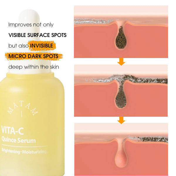 MATAM Vita-C Quince Serum