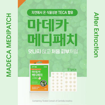 Madeca MediPatch After Extraction Spotpatch - 51pcs