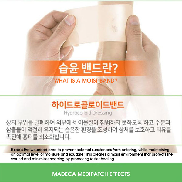 Madeca MediPatch After Extraction Spotpatch - 51pcs