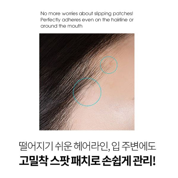 Acnes Blemish All Clear Spot Patch - After Care