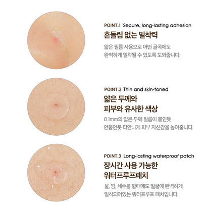 Paul Medison CareDerm Thin Spotpatch Honey