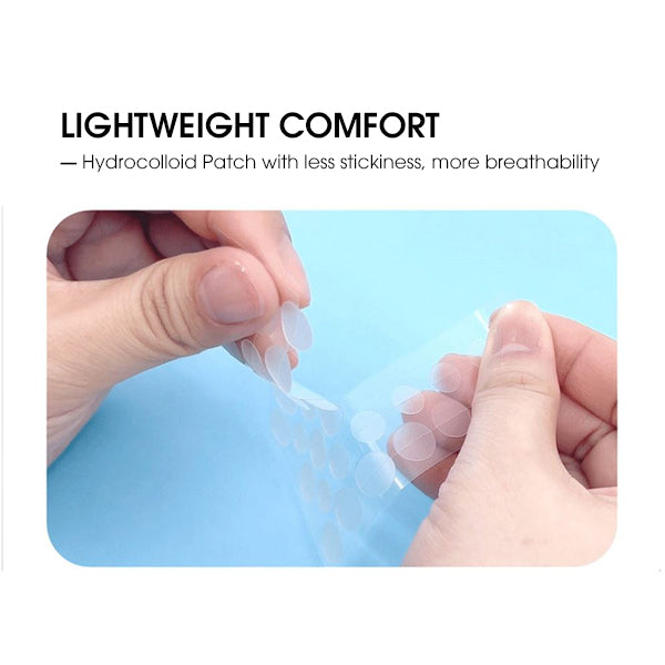 Acnes Blemish All Clear Spot Patch - After Care