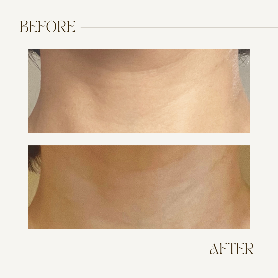 Dr GNO Nitric Oxide Night Recovery Oil Essence